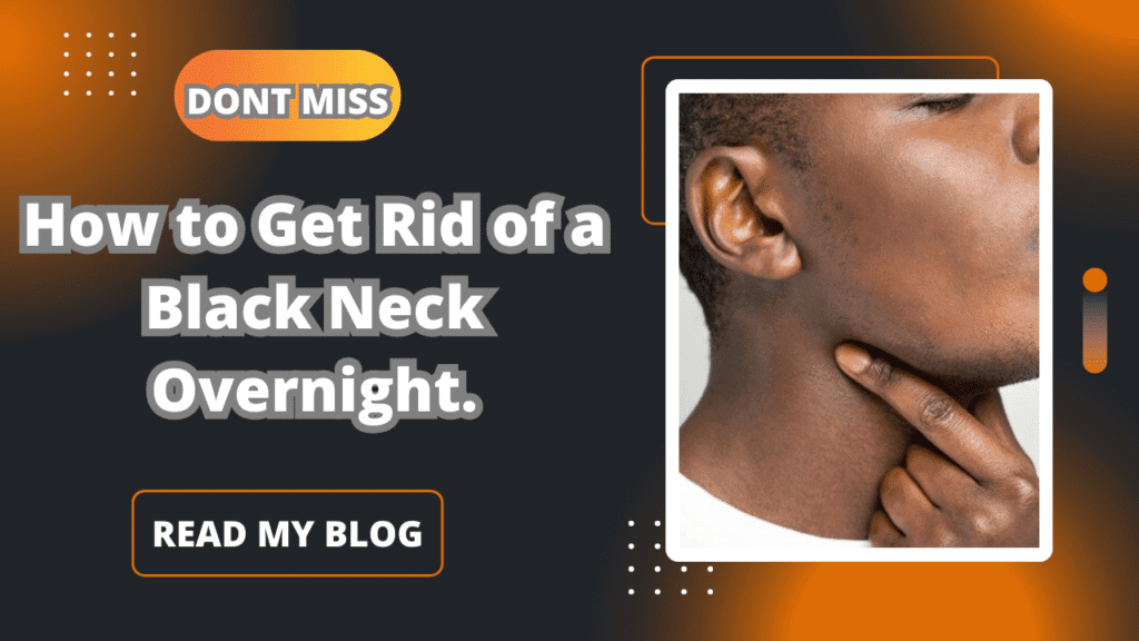 How to Get Rid of a Black Neck Overnight